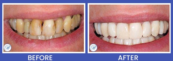 Smile Gallery for Bell Family Dental in Bayside, NY