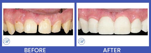 Smile Gallery for Bell Family Dental in Bayside, NY