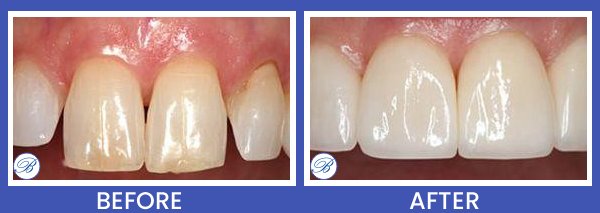 Smile Gallery for Bell Family Dental in Bayside, NY