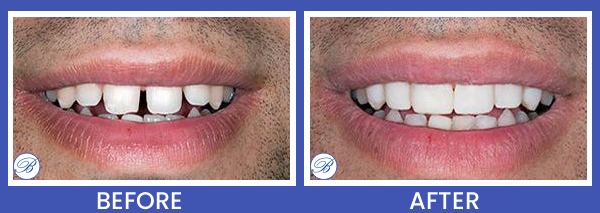 Smile Gallery for Bell Family Dental in Bayside, NY