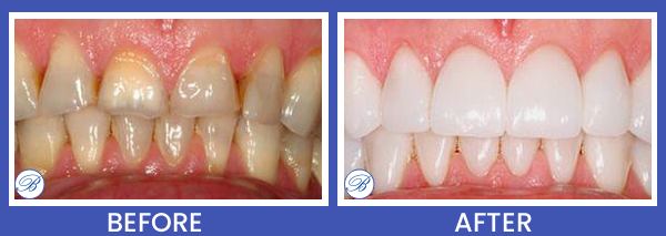 Smile Gallery for Bell Family Dental in Bayside, NY