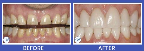 Smile Gallery for Bell Family Dental in Bayside, NY