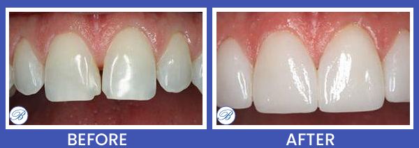 Smile Gallery for Bell Family Dental in Bayside, NY