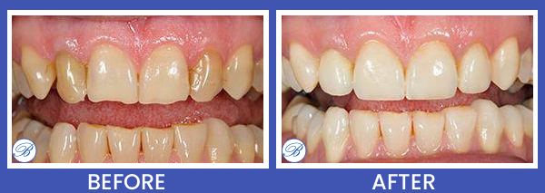 Smile Gallery for Bell Family Dental in Bayside, NY