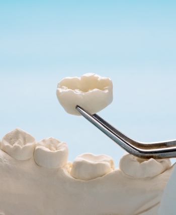 All Porcelain Crowns - Bell Family Dental in Bayside, NY