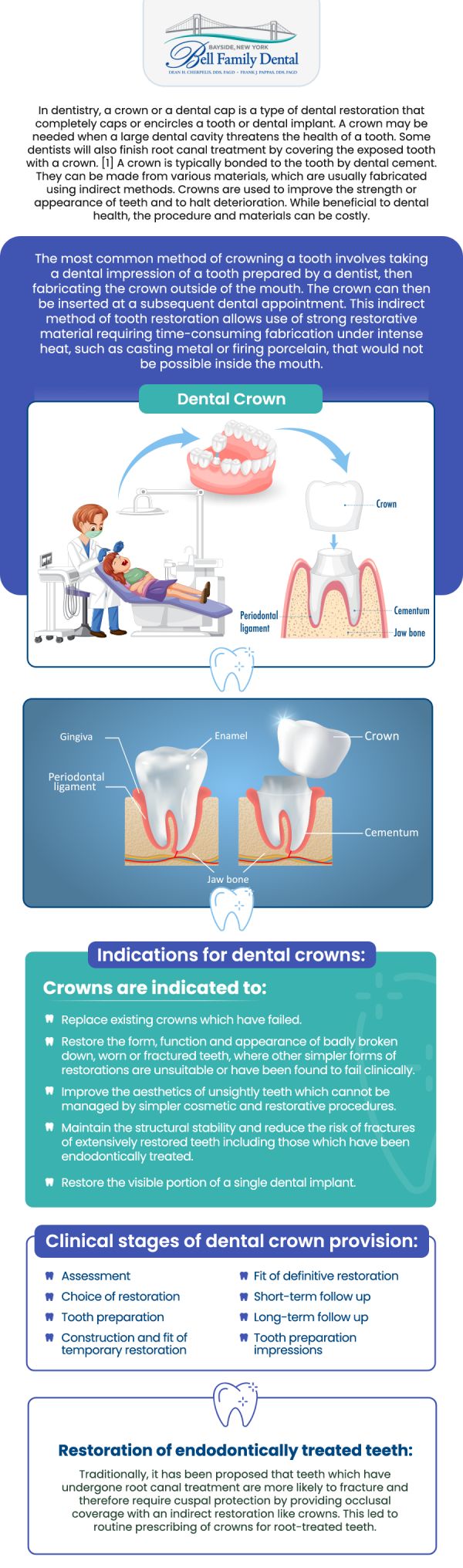If you have a tooth that is cracked, severely decayed, or weakened, all-porcelain dental crowns provide a durable and aesthetically pleasing solution to restore its strength and function. At Bell Family Dental, Dean Cherpelis, DDS, FAGD, Frank Pappas, DDS, FAGD, and Theodore Davantzis, DDS, FAGD provide customized porcelain crowns designed to blend seamlessly with the color, shape, and natural appearance of your existing teeth. For more information, contact us or request an appointment online. We are conveniently located at 33-03 Bell Blvd, Bayside, NY 11361.