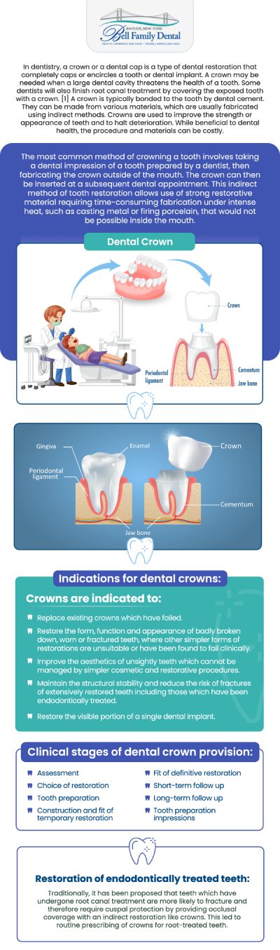 If you have a tooth that is cracked, severely decayed, or weakened, all-porcelain dental crowns provide a durable and aesthetically pleasing solution to restore its strength and function. At Bell Family Dental, Dean Cherpelis, DDS, FAGD, Frank Pappas, DDS, FAGD, and Theodore Davantzis, DDS, FAGD provide customized porcelain crowns designed to blend seamlessly with the color, shape, and natural appearance of your existing teeth. For more information, contact us or request an appointment online. We are conveniently located at 33-03 Bell Blvd, Bayside, NY 11361.
