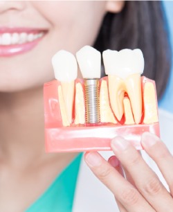 Dental Implants - Bell Family Dental in Bayside, NY