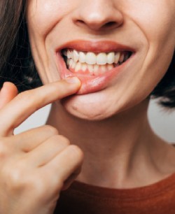 Bleeding Gums - Bell Family Dental in Bayside, NY
