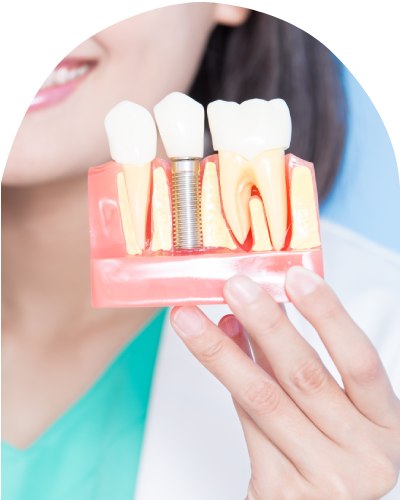 Dental Implants - Bell Family Dental in Bayside, NY