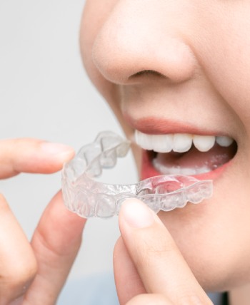 Invisalign - Bell Family Dental in Bayside, NY