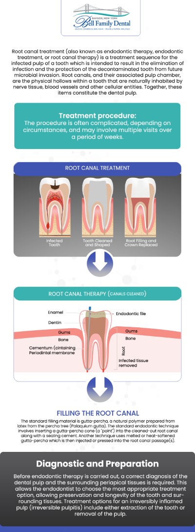 If you are searching for root canal treatment in Bayside, NY, Bell Family Dental provides gentle, pain-relieving dental care. While many people fear root canals, modern techniques and effective local anesthesia help make the procedure more comfortable, often comparable to receiving a routine filling. Dean Cherpelis, DDS, FAGD, Frank Pappas, DDS, FAGD, and Theodore Davantzis, DDS, FAGD focus on removing infected pulp tissue, carefully cleaning and disinfecting the root canals, and restoring your tooth’s strength and function with an appropriate restoration, such as a durable custom crown. For more information, contact us or request an appointment online. We are conveniently located at 33-03 Bell Blvd, Bayside, NY 11361.