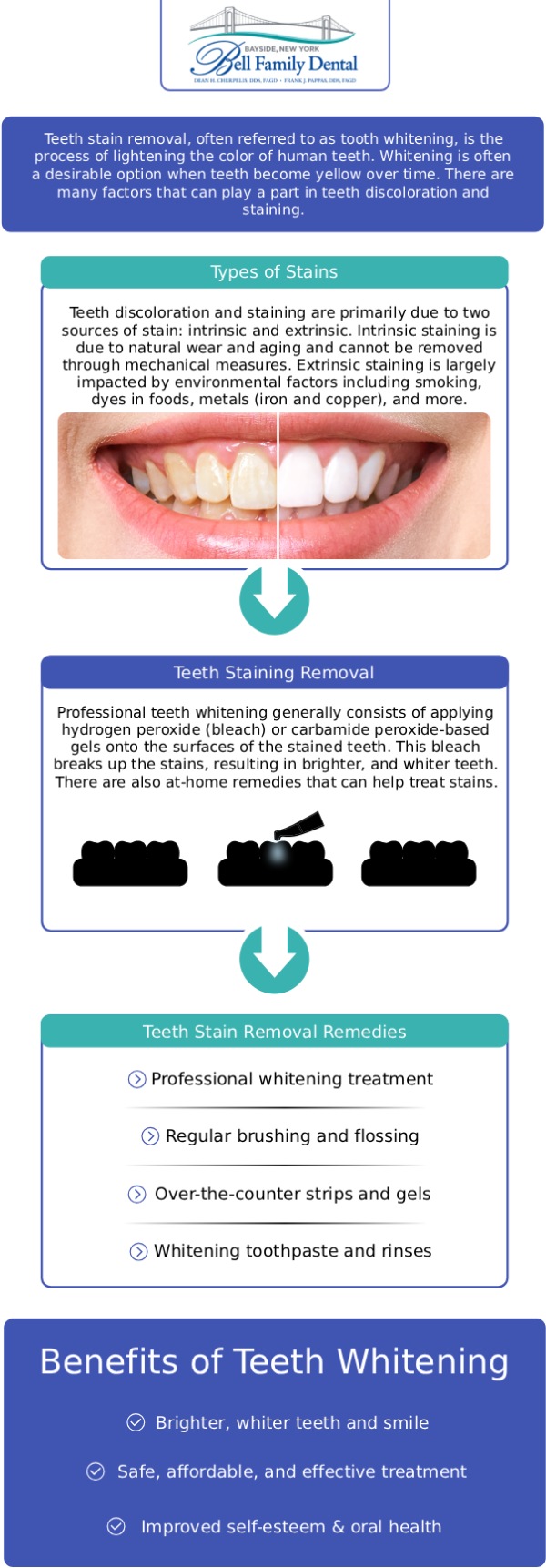 Common questions asked by patients: What causes stained or discolored teeth? What is the most effective treatment for deeply stained teeth? Can all types of tooth discoloration be fixed with traditional whitening? How can Bell Family Dental help me treat my stained teeth? For more information, contact us or request an appointment online. We are conveniently located at 33-03 Bell Blvd, Bayside, NY 11361. Common questions asked by patients: What causes stained or discolored teeth? What is the most effective treatment for deeply stained teeth? Can all types of tooth discoloration be fixed with traditional whitening? How can Bell Family Dental help me treat my stained teeth? For more information, contact us or request an appointment online. We are conveniently located at 33-03 Bell Blvd, Bayside, NY 11361.