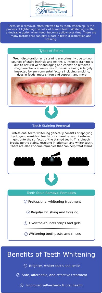 Common questions asked by patients: What causes stained or discolored teeth? What is the most effective treatment for deeply stained teeth? Can all types of tooth discoloration be fixed with traditional whitening? How can Bell Family Dental help me treat my stained teeth? For more information, contact us or request an appointment online. We are conveniently located at 33-03 Bell Blvd, Bayside, NY 11361. Common questions asked by patients: What causes stained or discolored teeth? What is the most effective treatment for deeply stained teeth? Can all types of tooth discoloration be fixed with traditional whitening? How can Bell Family Dental help me treat my stained teeth? For more information, contact us or request an appointment online. We are conveniently located at 33-03 Bell Blvd, Bayside, NY 11361.