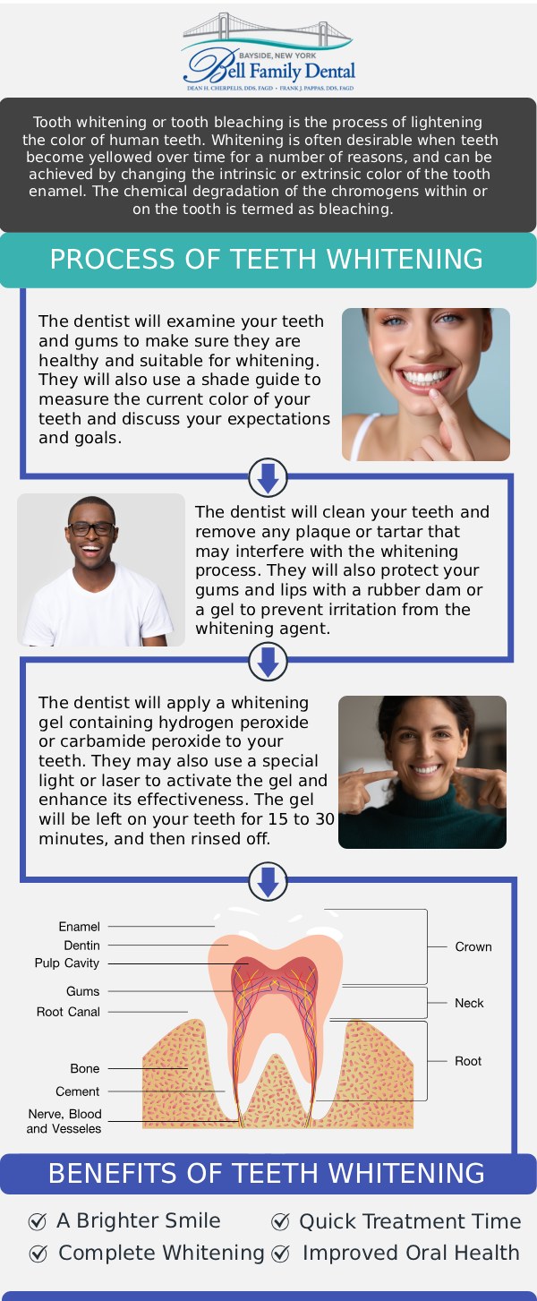 If you want to safely lift stubborn stains from coffee, wine, or aging and dramatically brighten your smile, professional teeth whitening offers effective, reliable results. At Bell Family Dental in Bayside, NY, Dean Cherpelis, DDS, FAGD, Frank Pappas, DDS, FAGD, and Theodore Davantzis, DDS, FAGD provide advanced in-office treatments and custom take-home whitening kits designed to help you achieve your desired shade safely and effectively. For more information, contact us or request an appointment online. We are conveniently located at 33-03 Bell Blvd, Bayside, NY 11361.