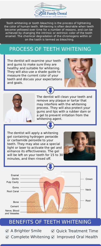 If you want to safely lift stubborn stains from coffee, wine, or aging and dramatically brighten your smile, professional teeth whitening offers effective, reliable results. At Bell Family Dental in Bayside, NY, Dean Cherpelis, DDS, FAGD, Frank Pappas, DDS, FAGD, and Theodore Davantzis, DDS, FAGD provide advanced in-office treatments and custom take-home whitening kits designed to help you achieve your desired shade safely and effectively. For more information, contact us or request an appointment online. We are conveniently located at 33-03 Bell Blvd, Bayside, NY 11361.